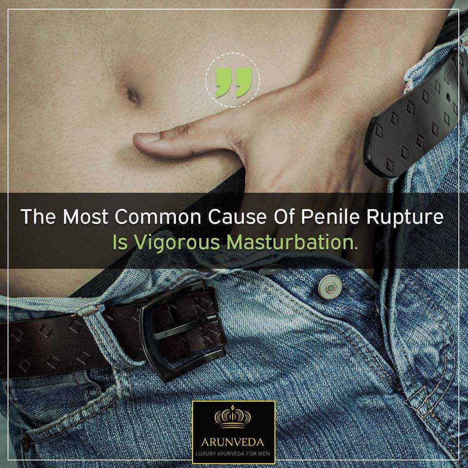 And it definitely hurts!